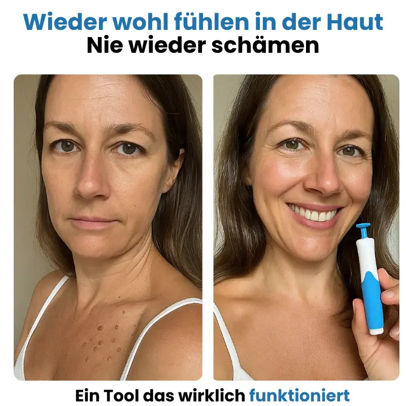 HEVILUXY™ Komplett-Set – Für Hautanhängsel-Bedürfnisse